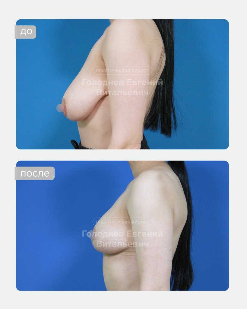 46.jpg